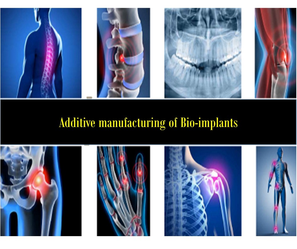 Magnesium Bio-implants